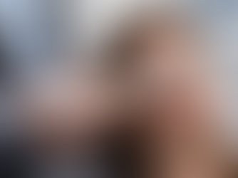 IPL Therapy in Milwaukee