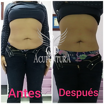 Acupuntura Estetica 09.png