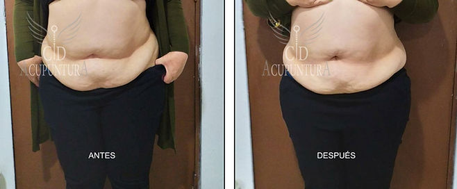 antes y despues.jpg