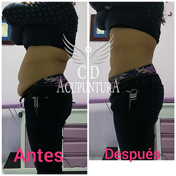 Acupuntura Estetica 11.png