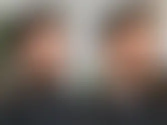 Beard Transformation Before After Explained