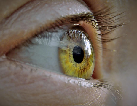 Auge