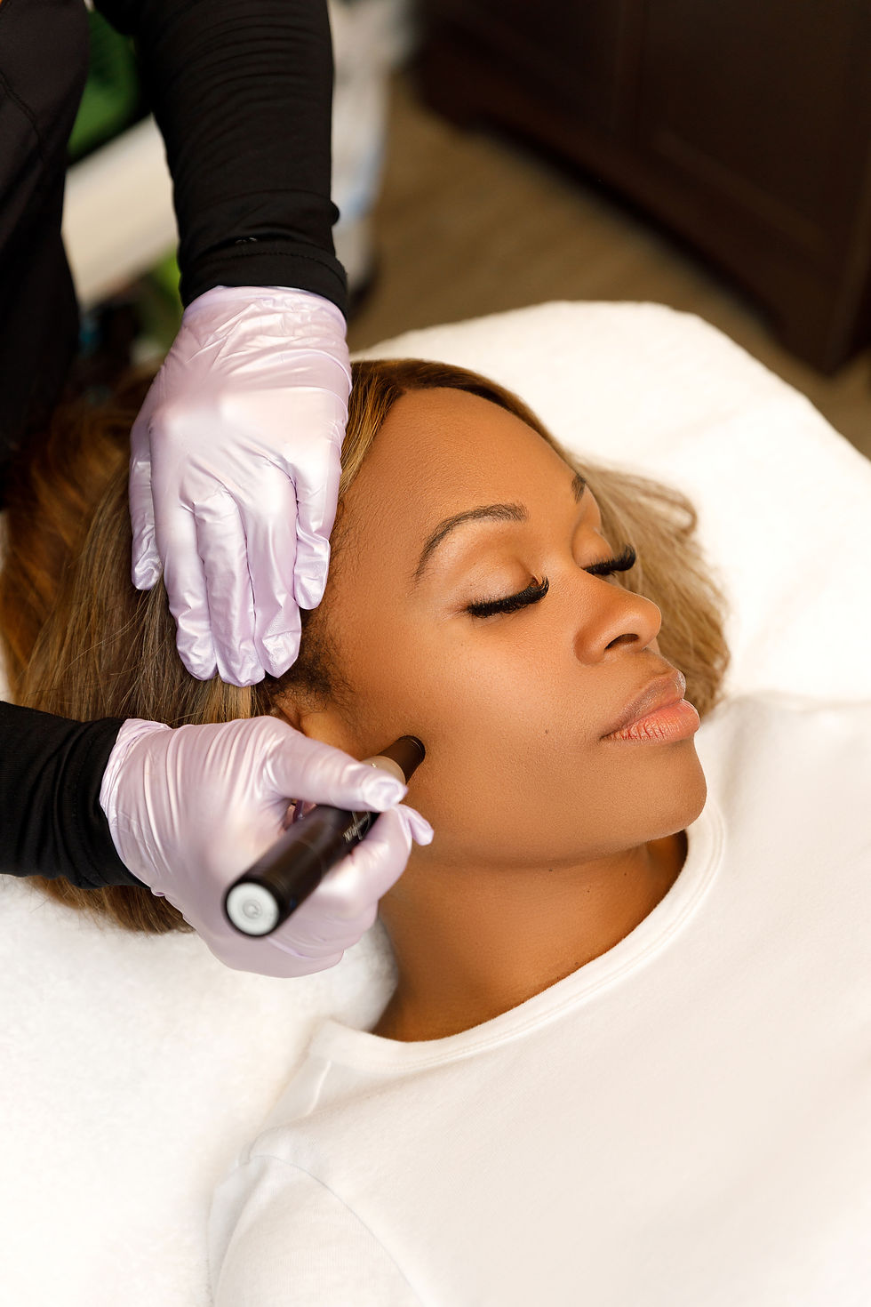 Smoother Skin Starts Here: Your Guide to Microneedling