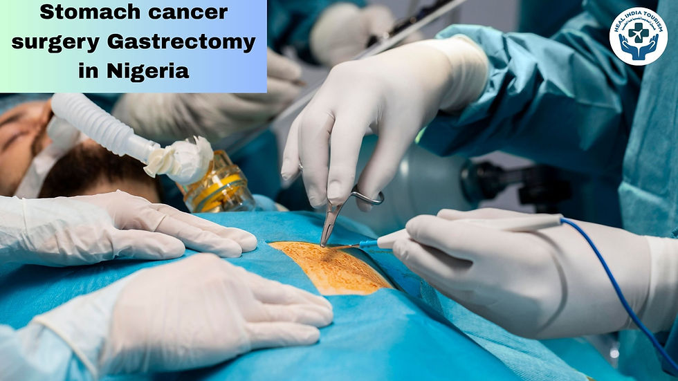 Stomach cancer surgery Gastrectomy in Nigeria