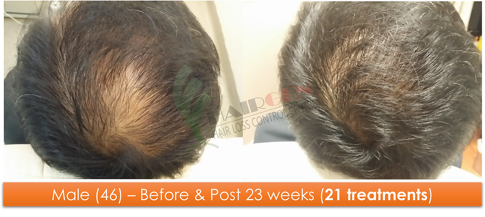 Male (44) - 21 sessions over 23 weeks