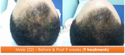 Male (22) - 9 sessions over 9 weeks