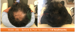 Male (38) - 14 sessions over 16 weeks