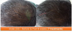 Male (33) - 7 sessions over 8 weeks