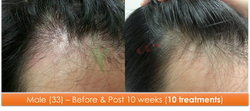 Male (33) - 10 sessions over 10 weeks