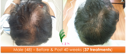 Male (48) - 37 sessions over 40 weeks