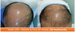 Male (39) - 28 sessions over 29 weeks