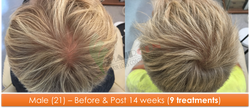 Male (21) - 9 sessions over 14 weeks