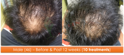 Male (46) - 10 sessions over 12 weeks