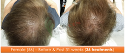 Female (56) - 36 sessions over 31 weeks