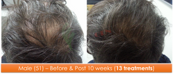 Male (51) - 13 sessions over 10 weeks
