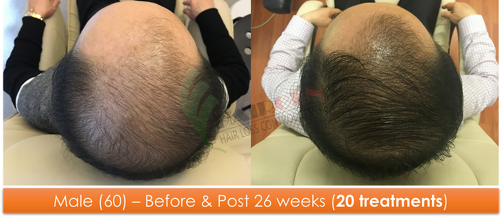 Male (60) - 20 sessions over 26 weeks