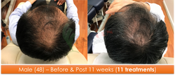 Male (48) - 11 sessions over 11 weeks
