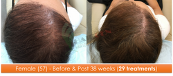Female (57) - 29 sessions over 38 weeks