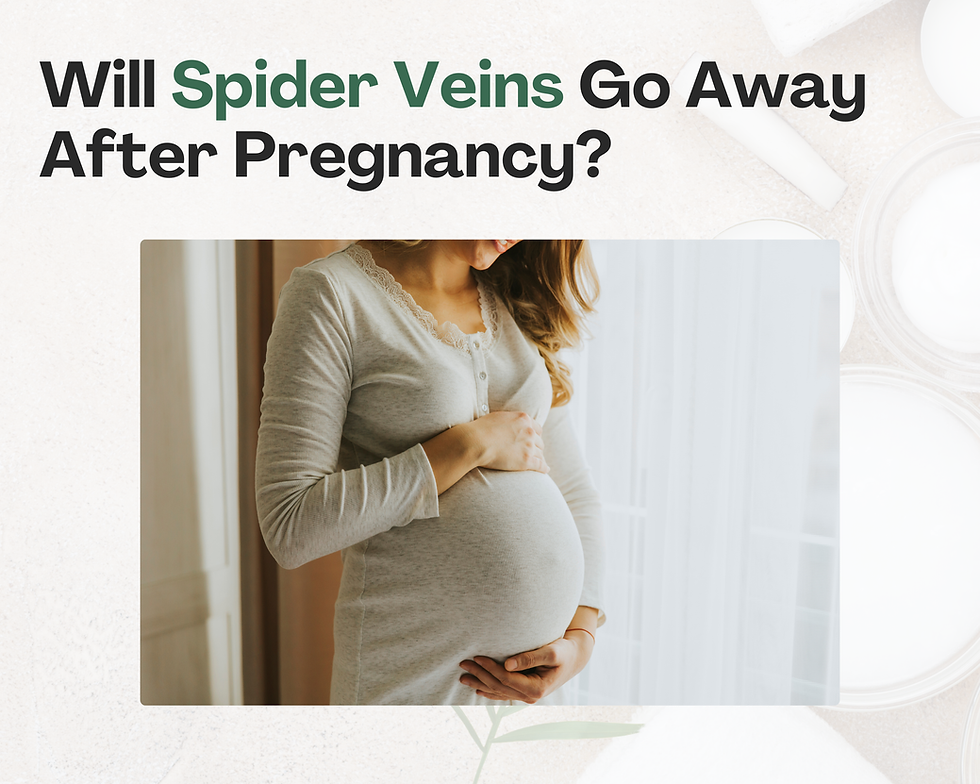 A thumbnail with the title "Will Spider Veins Go Away After Pregnancy?" with an image of a pregnant woman.