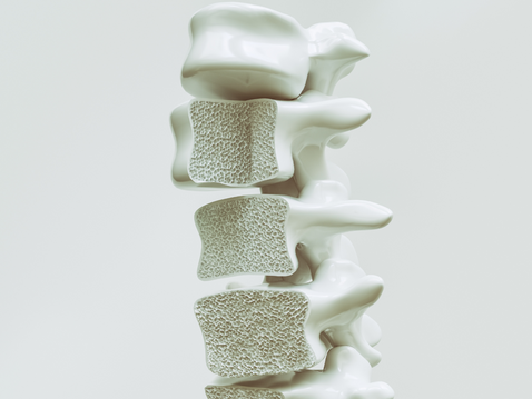How does exercise help manage Osteoporosis?
