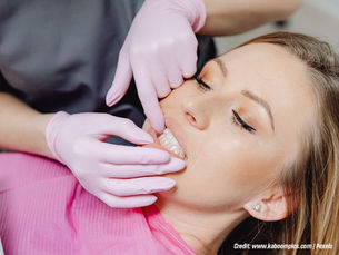 5 Reasons to Choose a Family Dentist for Professional Teeth Whitening