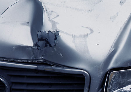 Paintless Dent Repair1