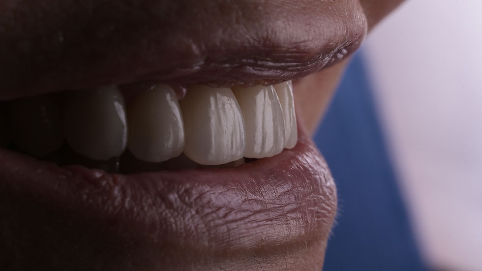 Photo d'un sourire après un soin de réhabilitation fonctionnelle et esthétique