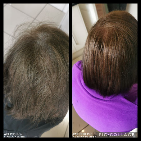 Grey roots