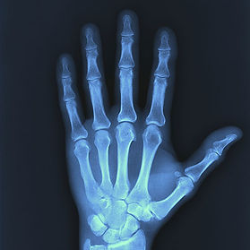 x-ray