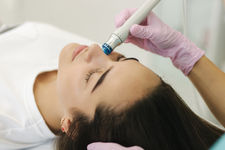 microdermabrasion