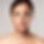 Venus Viva treatment reducing fine lines and wrinkles for a youthful appearance