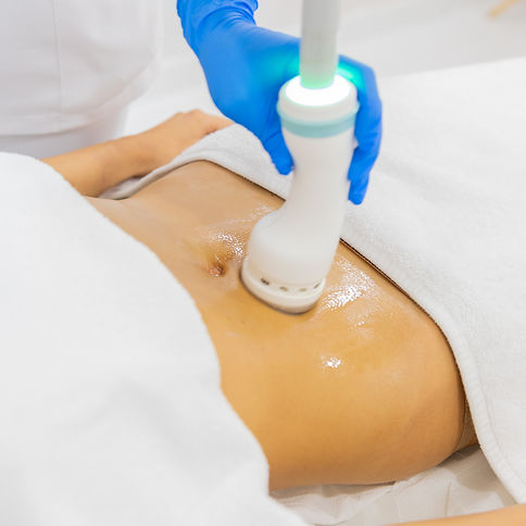 Onda Coolwaves in dubai body contouring treatment at Eden Aesthetics for non-invasive fat reduction and cellulite smoothing.