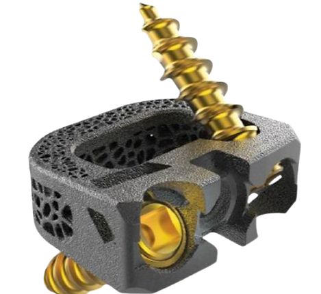 Stand-Alone C Cage.png