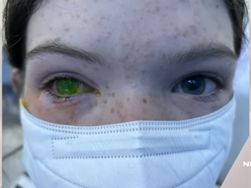 Doença deixa os ‘olhos verdes’ e assusta australianos