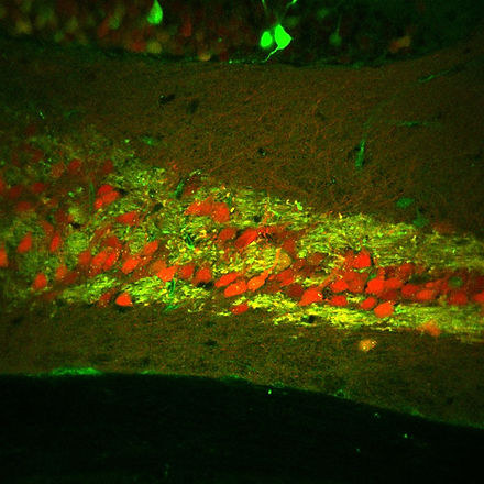 mouseIL_inj06Sep22_slice7_CAMKII_MSCRE4_MERGED.jpg