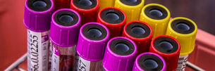 Lupus et infections : prévention et vigilance