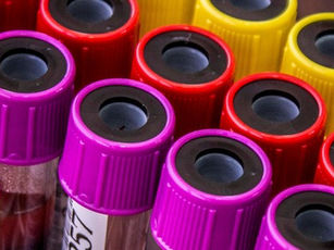 Lupus e infecciones: prevención y vigilancia