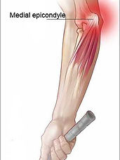 golfer's-elbow.jpg