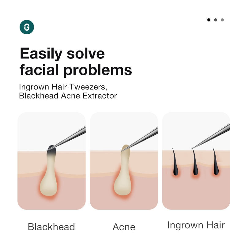 Thumbnail: Beauty Tweezer With Pointed Ends 