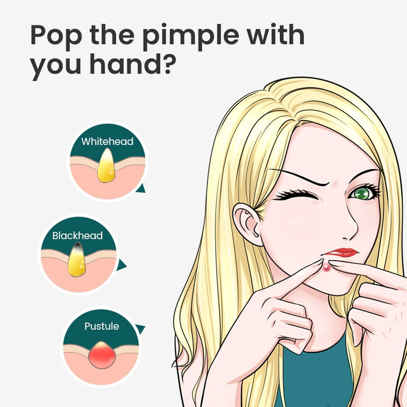 Thumbnail: Professional Blackhead Remover - Acne Removal Needle 