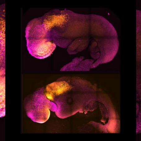 Synthetic Mouse Embryo