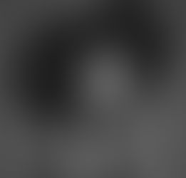 Hair Relaxer Lawsuit Update:  Why the ‘Creamy Crack’ Is Facing Global Backlash.