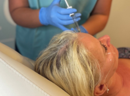 Client receiving anti-wrinkle injections at Crane Medical Clinic in Little Sutton, Ellesmere Port.