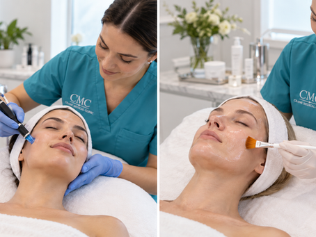 Hydrafacial vs Chemical Peel: Which Treatment Is Right for Your Skin?