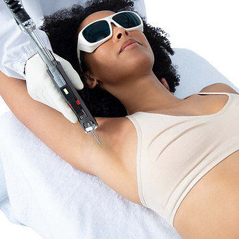 Client receiving laser hair removal treatment to the underarm using professional laser technology at Crane Medical Clinic.