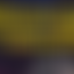 How deferred revenue and contract liabilities affect cash flow interpretation