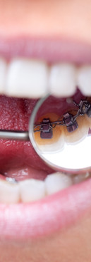 kieferorthopädie für kinder, jugendliche und erwachsene in adliswi, kilchberg, thalwil, rüschlikon, zürich, wettswil, horgen, langau am albis, orthodontics, zis, zahnspange, zahnstellungskorrektur, ortho, kfo, invisalgn, braces, orthoboutique, orthodent, 