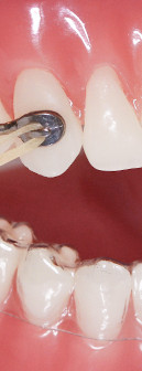 kieferorthopädie für kinder, jugendliche und erwachsene in adliswi, kilchberg, thalwil, rüschlikon, zürich, wettswil, horgen, langau am albis, orthodontics, zis, zahnspange, zahnstellungskorrektur, ortho, kfo, invisalgn, braces, orthoboutique, orthodent, 