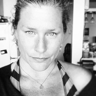 #freckleseason has begun..jpg