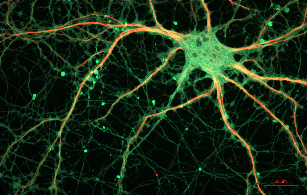 Neurons firing in the brain